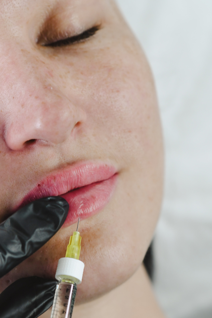 woman enlarges her lips with hyaluronic acid from a cosmetologist. Injection cosmetology. Lip fillers